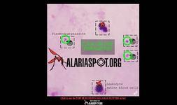 Pantalla del juego en el que se enseña al usuario a reconocer el parásito de la malaria en una muestra de sangre real digitalizada./