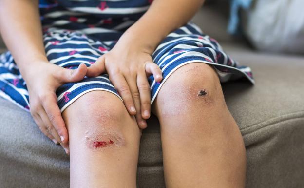 Cómo actuar ante una herida que sangra? | El Correo