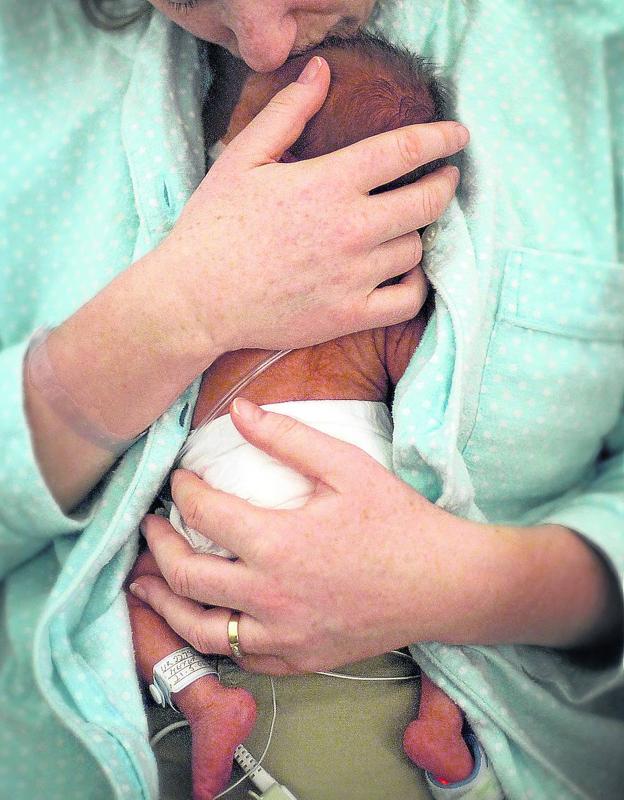 Un bebé de 3 meses es el primer vasco que recibe el medicamento más caro  del mundo | El Correo